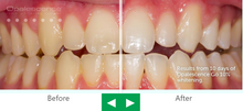 Last inn bildet i Galleri-visningsprogrammet, Opalescence Go Teeth Whitening

