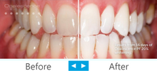 Last inn bildet i Galleri-visningsprogrammet, Opalescence PF Whitening
